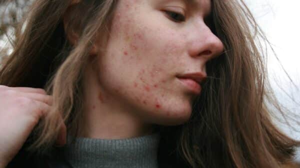 a woman with a substance on her face